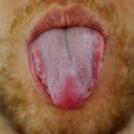 tongue